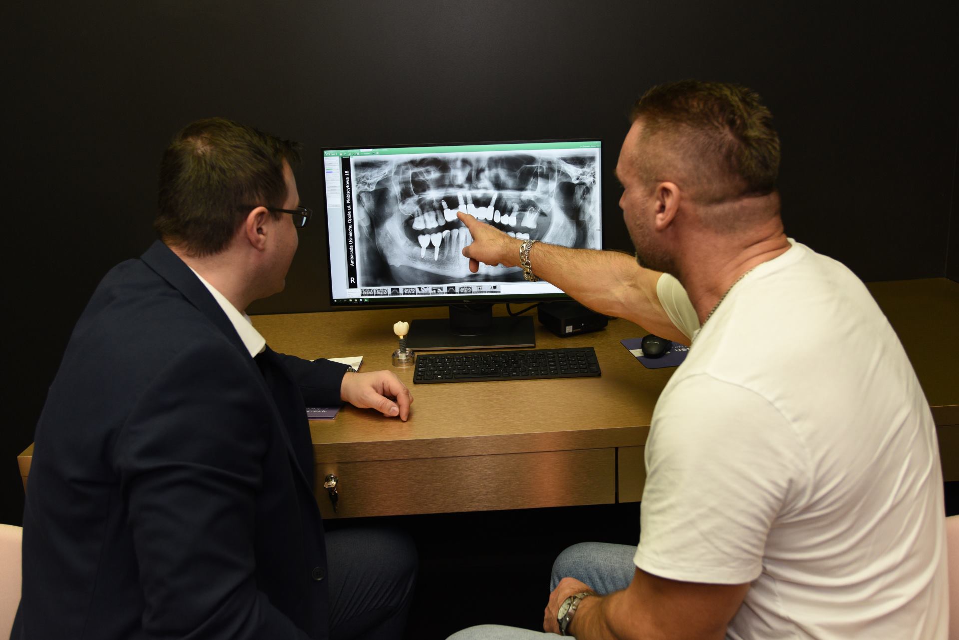 implant zęba Opole